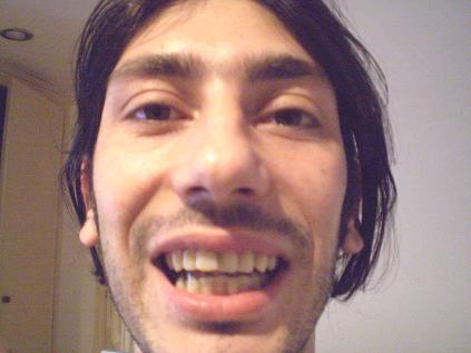 con bite aperta piccola.jpg